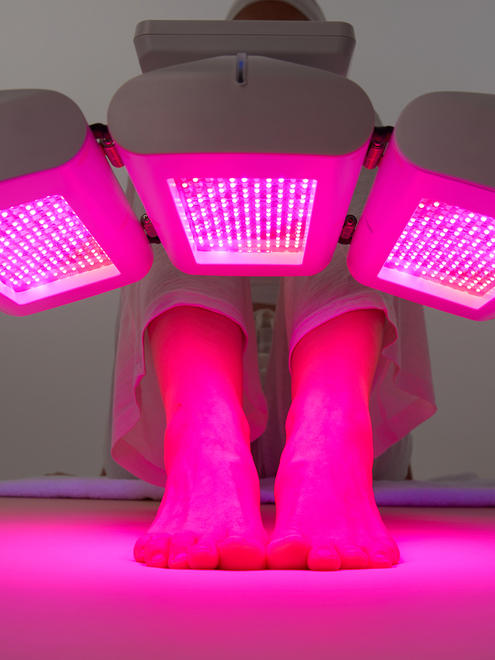 Фото аппарата REVIXAN ARC LED 3 №6