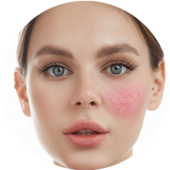 Дерматология