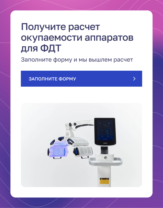 баннер-ссылка на форму для расчета окупаемости