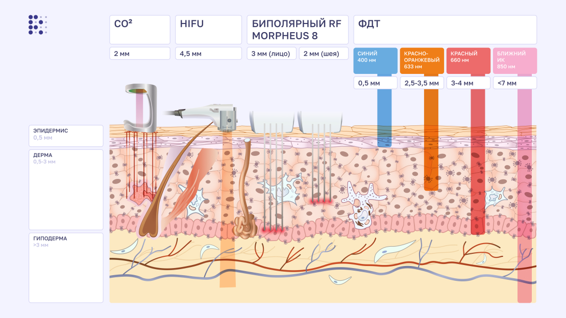 илююстрация воздействия разных косметологических аппаратов