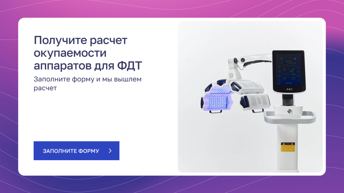 баннер-ссылка на форму для расчета окупаемости