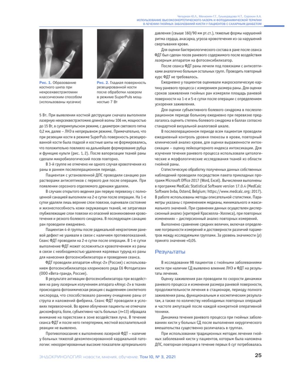 Bспользование лазера и фдт5